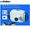 (LK-C26) Mobile Wireless Dental X Ray Machine
